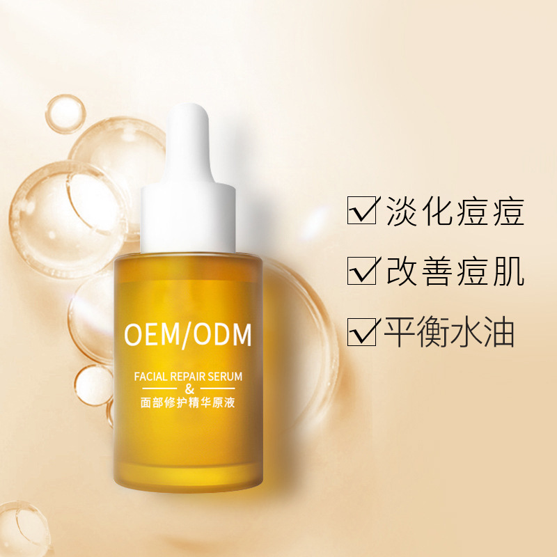 静安区_祛痘精华原液OEM